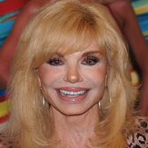 Loni Anderson